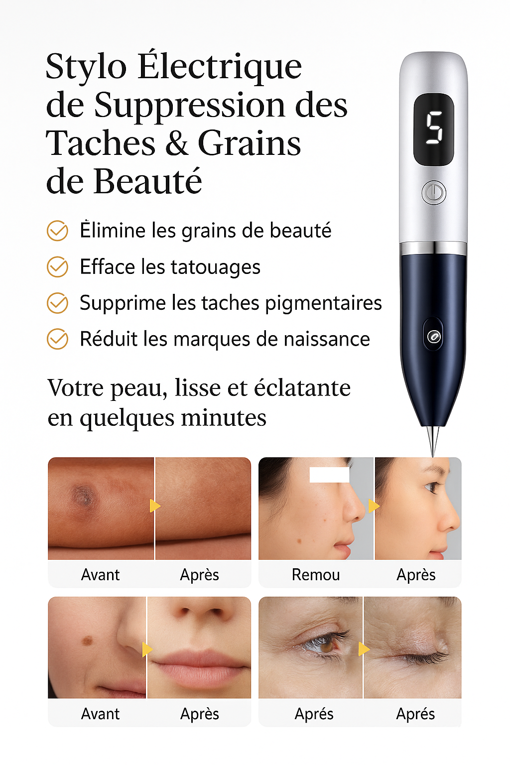 Plasma Pen Fibroblast – Stylo Plasma Anti-Âge & Épiderme Lifting Visage Maison